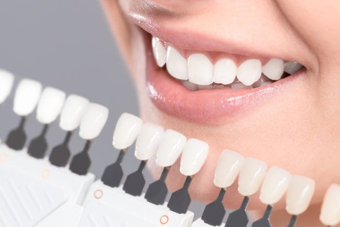 How do I whiten my teeth Manassas Va
