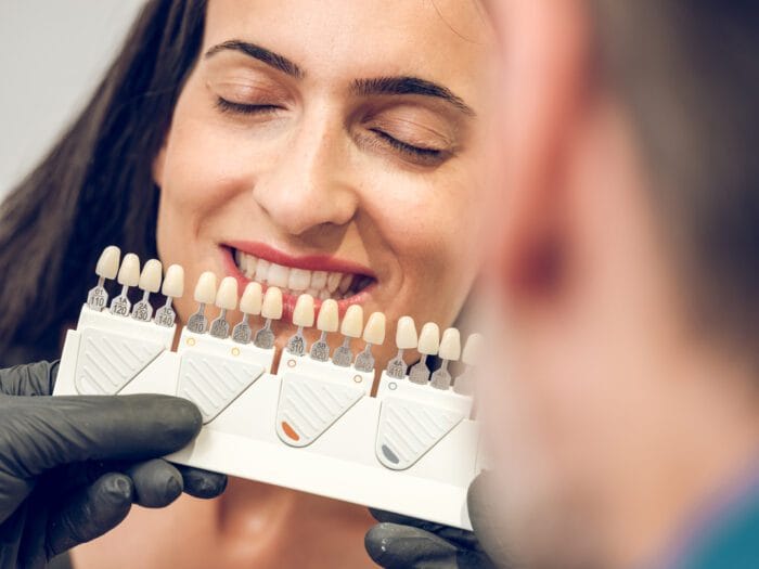 Porcelain Veneers