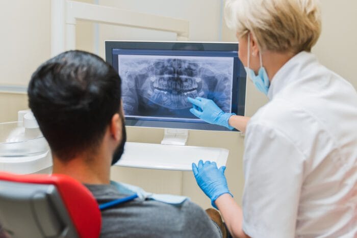 Root Canal