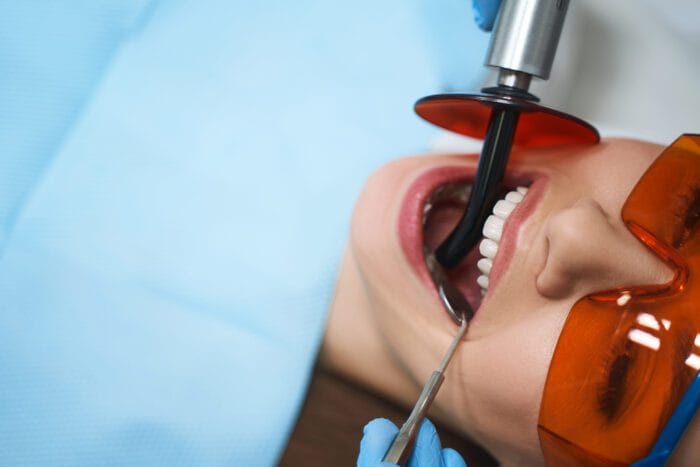 Root Canals