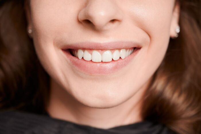 How to Get Rid of Yellow Teeth