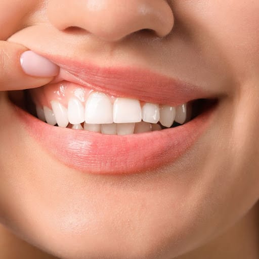 Gum Disease