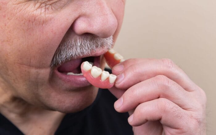 putting on dentures