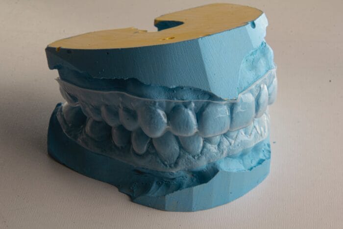 invisalign mold