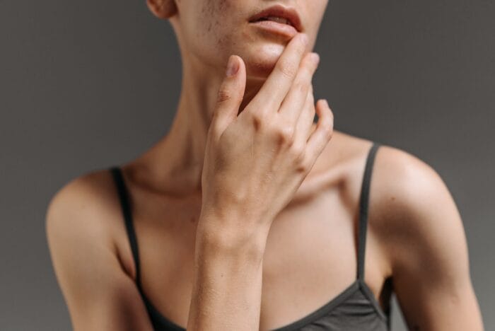 woman with toothache
