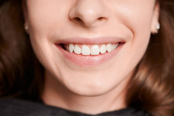What Are the Options for Uneven Teeth? What You Need to Know