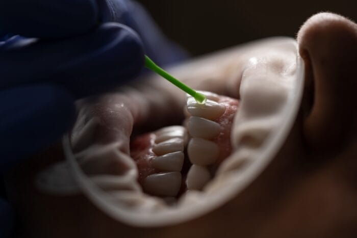 Crooked Teeth