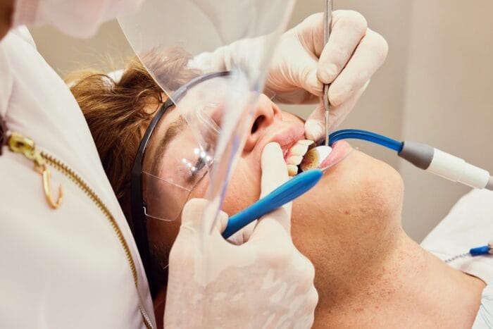 Dental Fillings