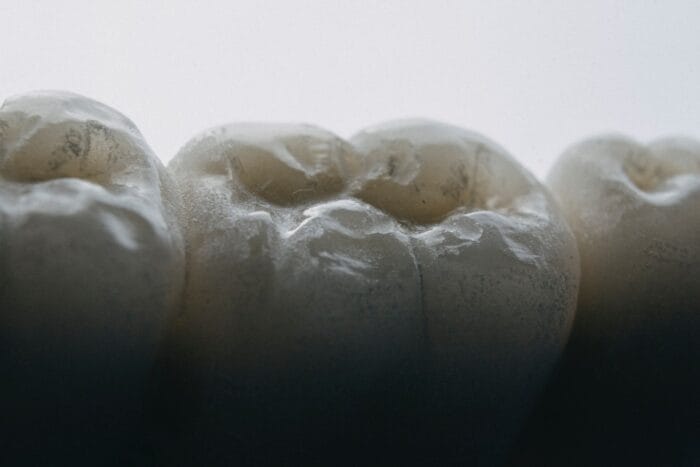 Tooth