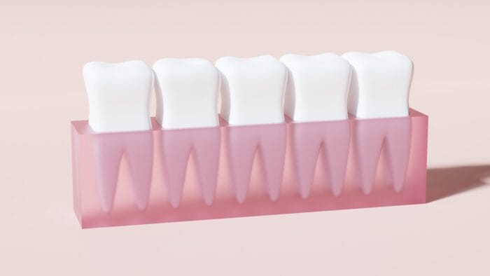 Root Canal