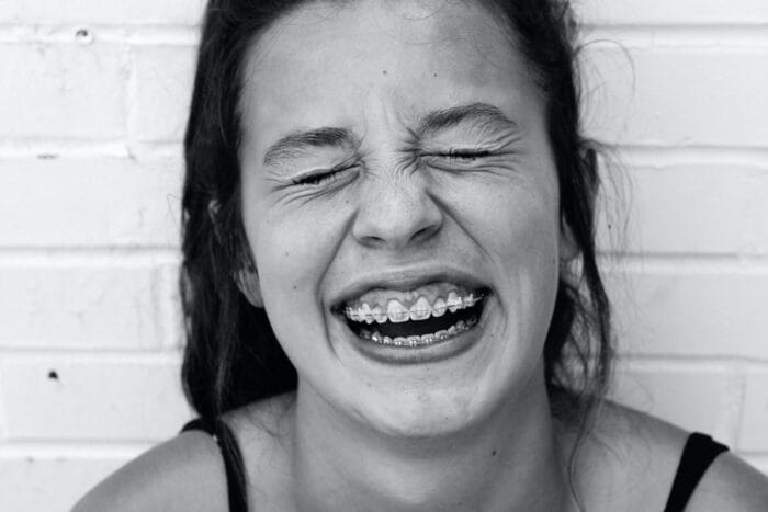 braces