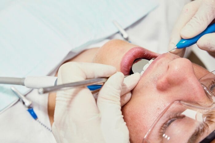 Tooth Stains
