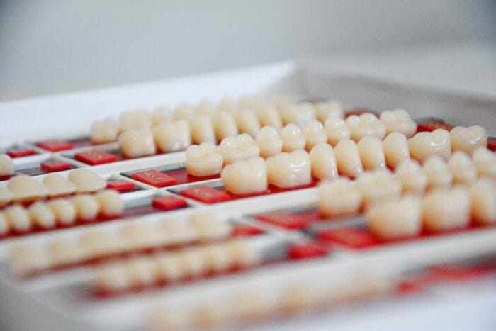 Veneer