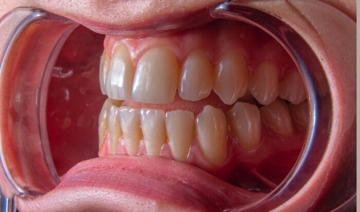 teeth