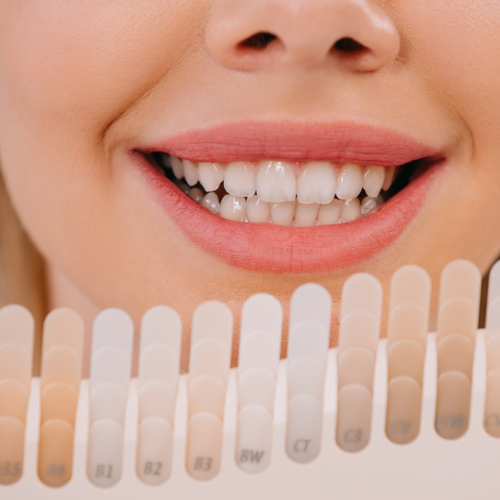 teeth whitening in manassas