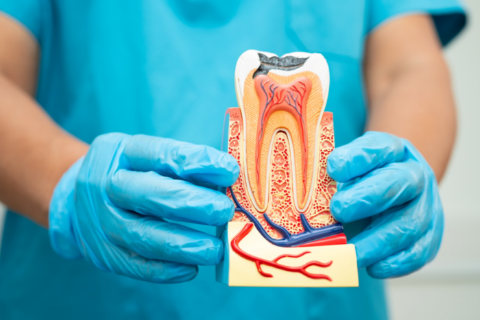 Is Root Canal Therapy Painful? Here’s the Truth
