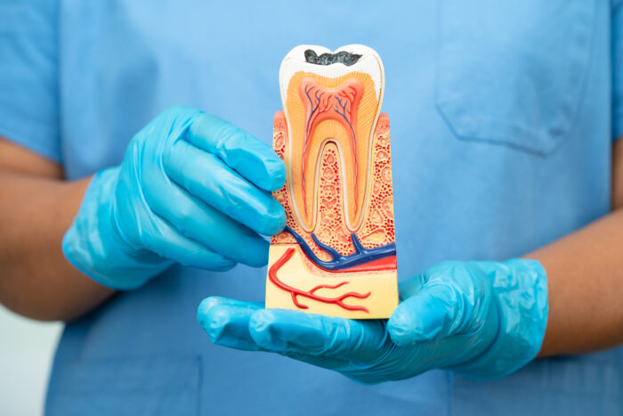 Root Canal Aftercare Tips for a Smooth Recovery