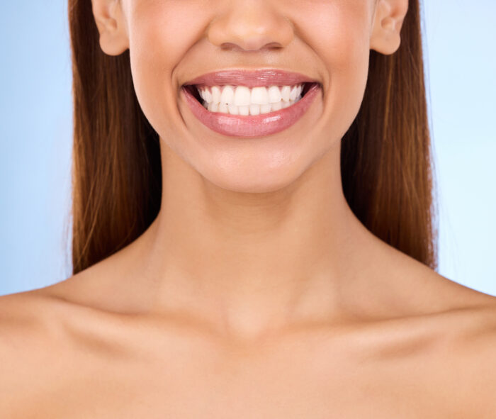How Can I Fix Stained or Discolored Teeth?