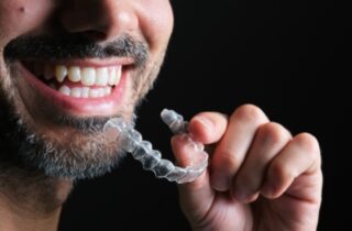 Smiling man holding clear Invisalign aligner for teeth alignment